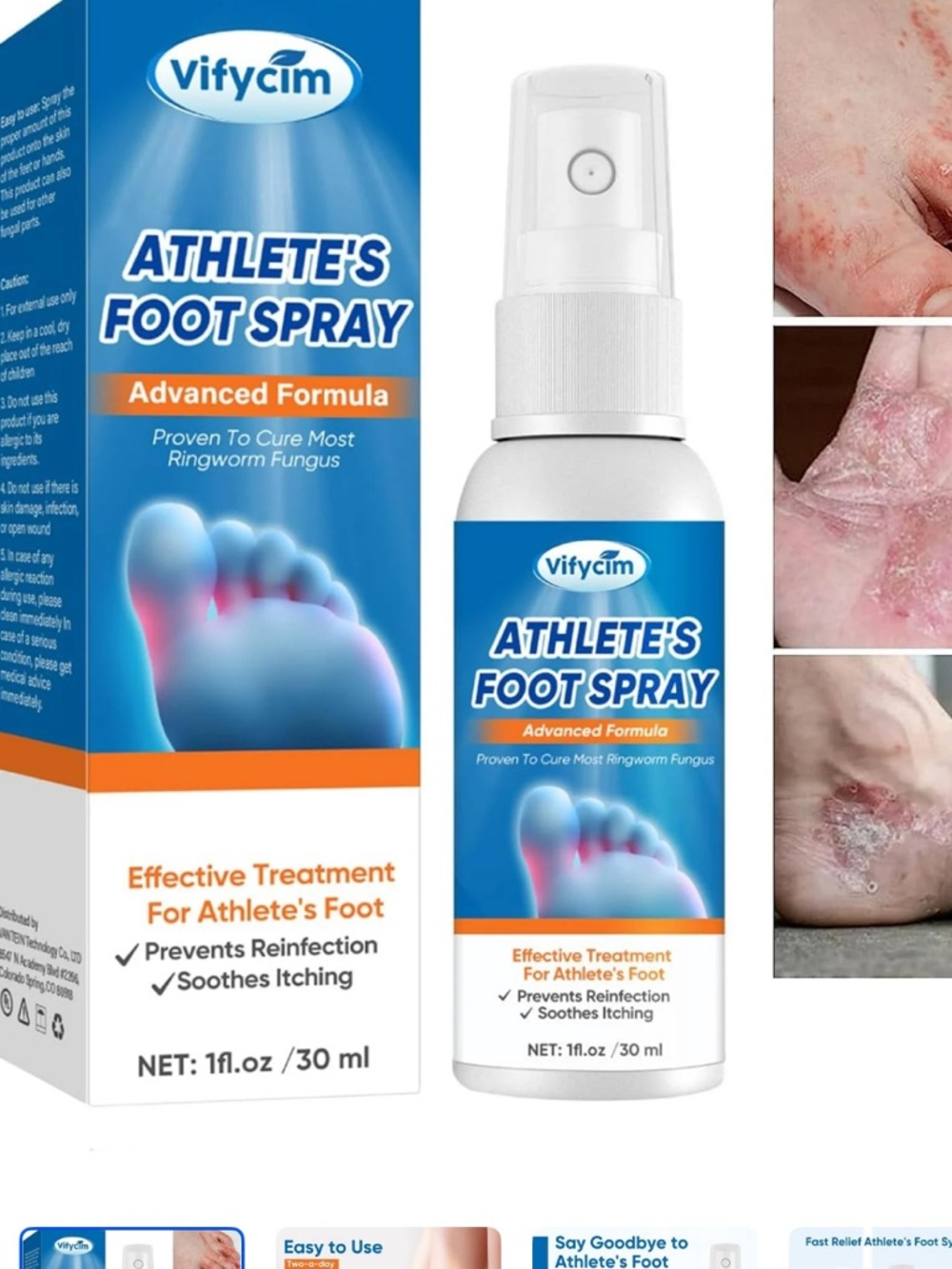 Vifycim Athlete's Foot Spray - Soothing Antifungal Spray set of 3